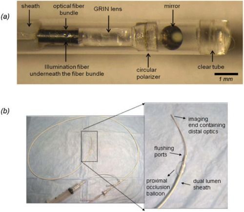 血管內(nèi)部激光成像技術(shù) 實(shí)現(xiàn)心臟病發(fā)作預(yù)測(cè)的元件與器件研發(fā)